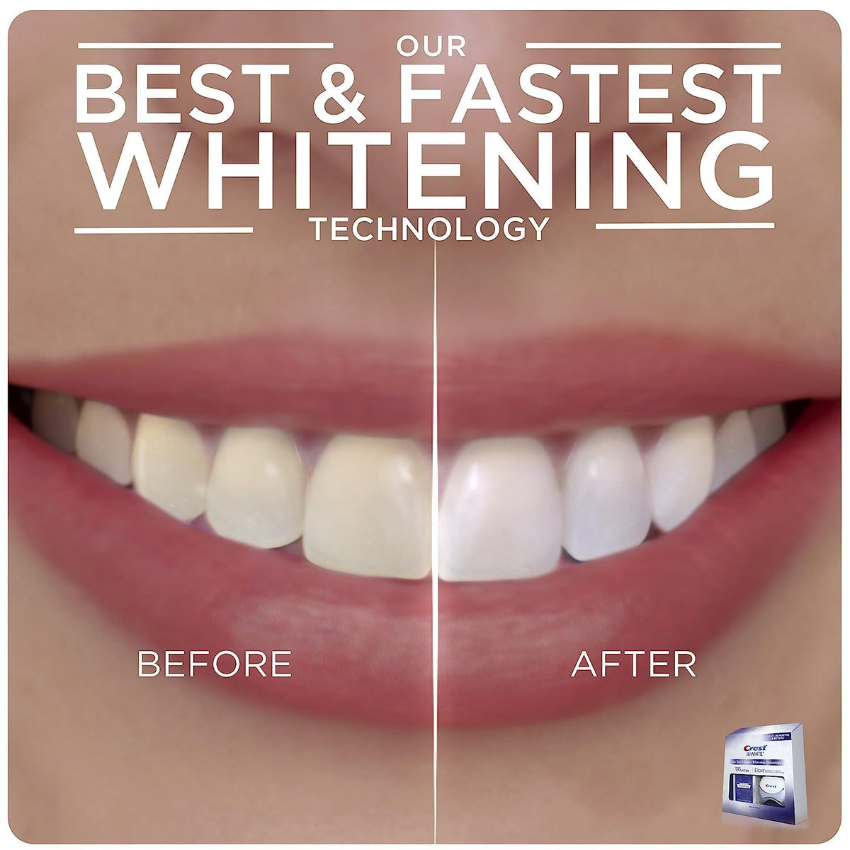 Crest 3D White Whitestrips With Light, Teeth Whitening Kit